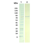 Human Transferrin Receptor/TFR1 C-terminal 6×His tag